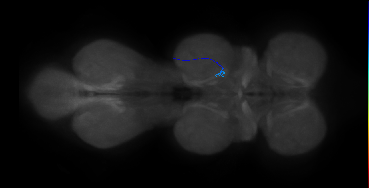 SNta24_MesoLN_R (MANC:39049)