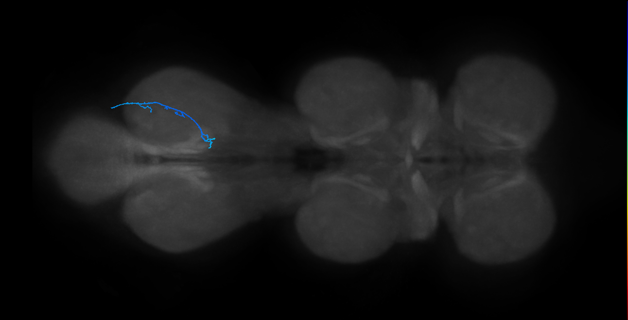 SNta15_MetaLN_R (MANC:39673)