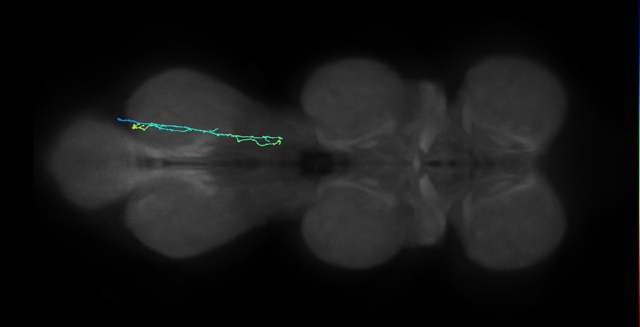 SNpp38_MetaLN_R (MANC:40104)