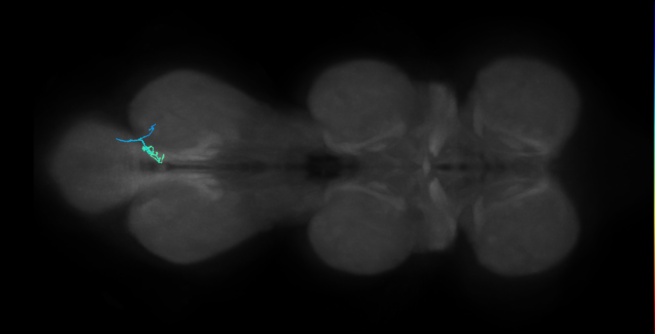 SNta19_MetaLN_R (MANC:43025)