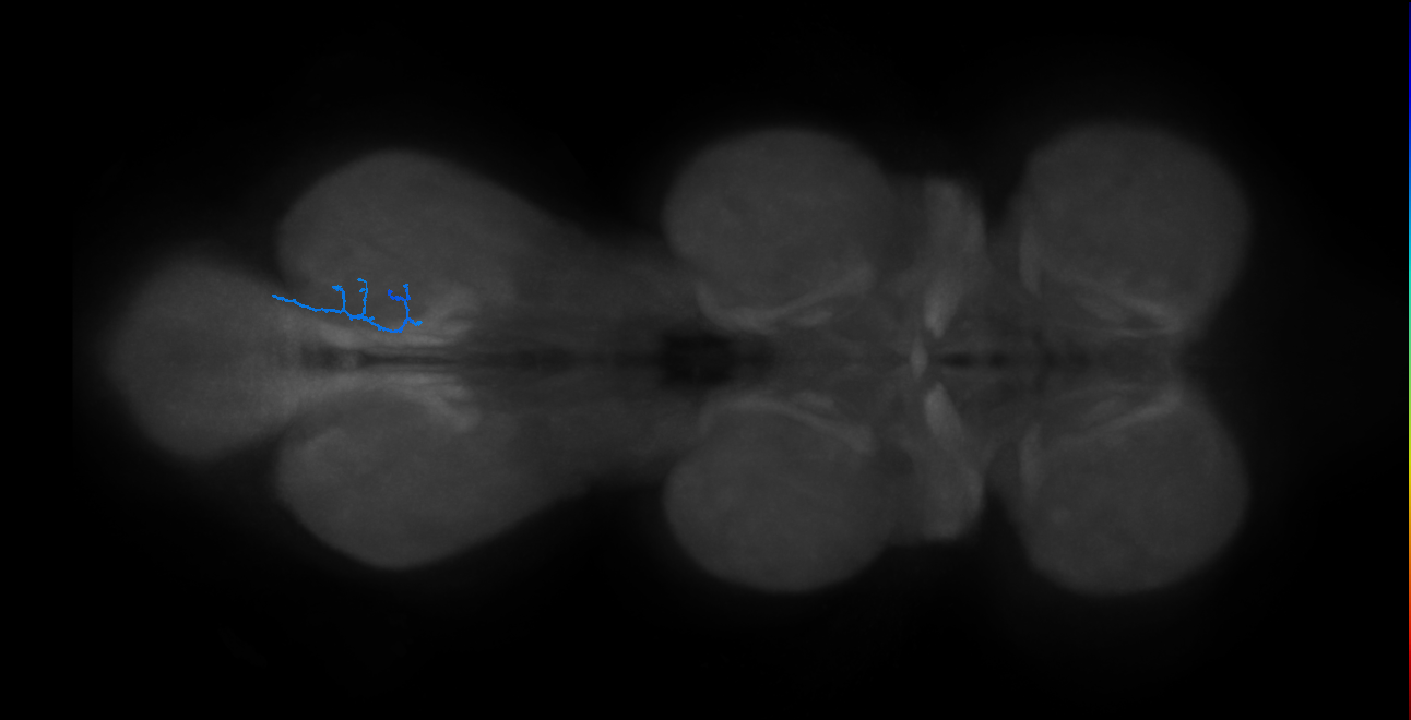 SNta23_MetaLN_R (MANC:43890)