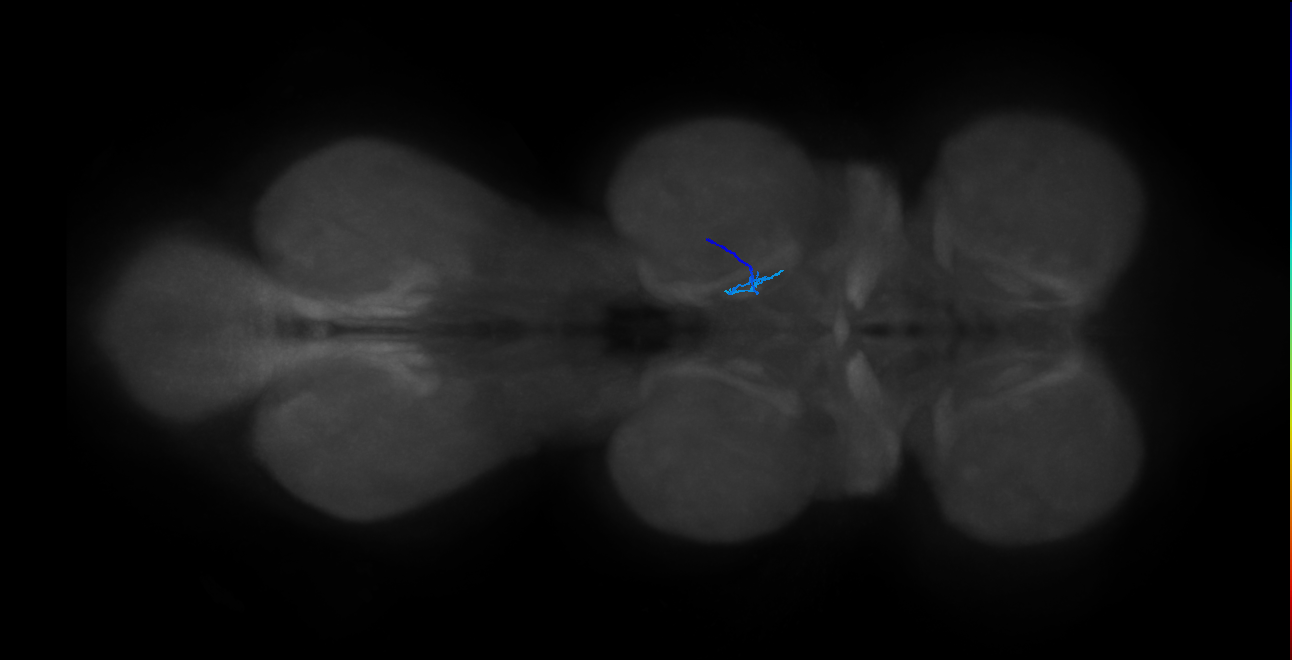 SNch08_MesoLN_R (MANC:44021)