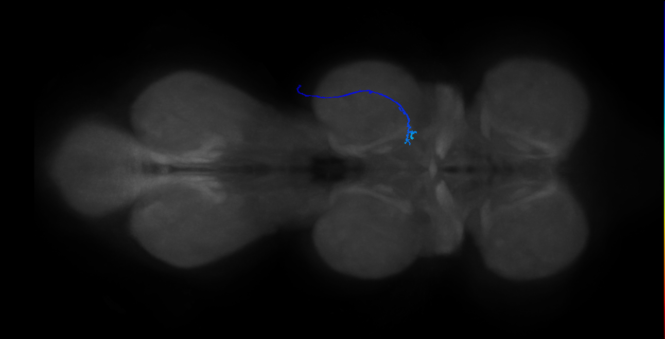 SNta16_MesoLN_R (MANC:44757)