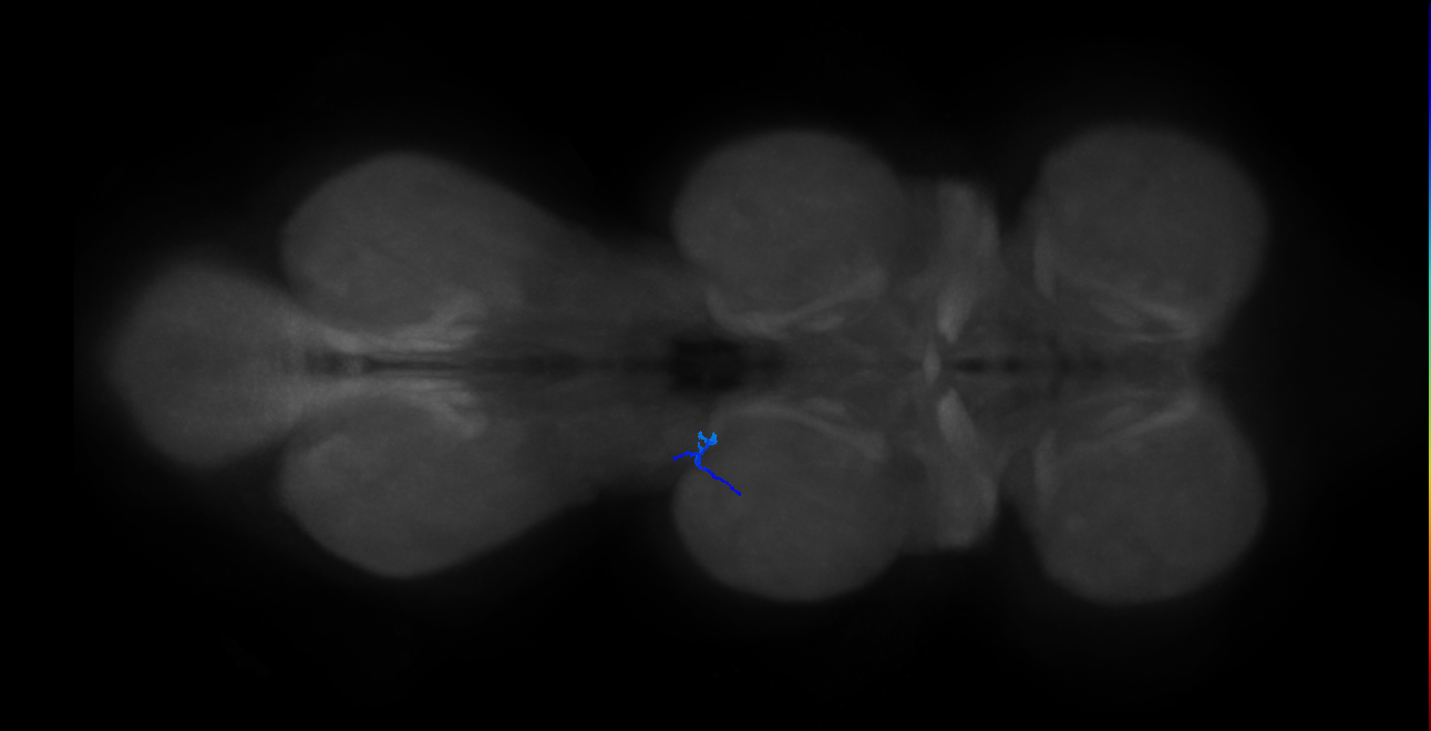 SNta19_MesoLN_L (MANC:45685)