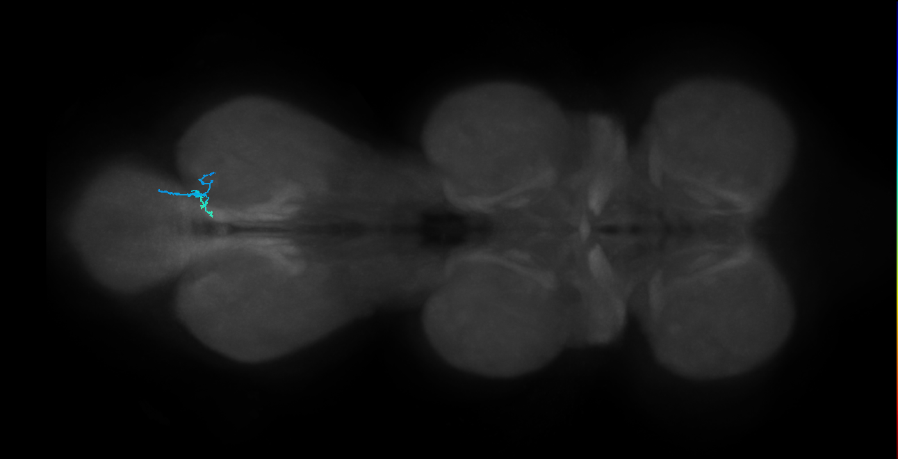 SNta22_MetaLN_R (MANC:45998)