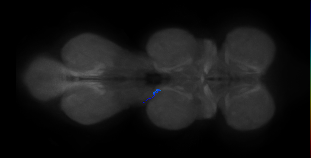 SNta22_MesoLN_L (MANC:46415)