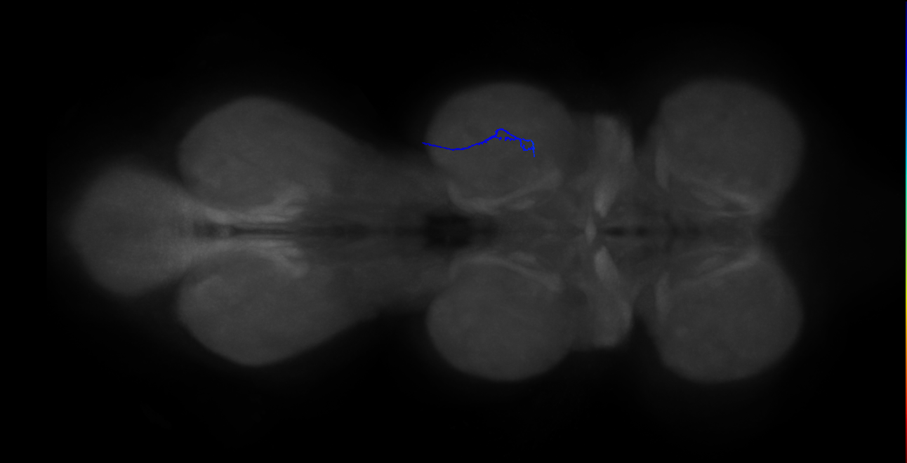 SNta19_MesoLN_R (MANC:47866)