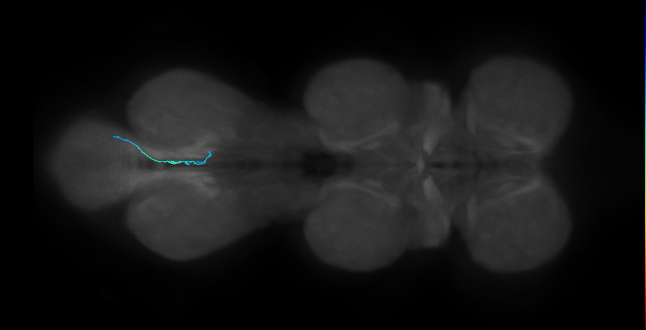 SNch14_MetaLN_R (MANC:48674)