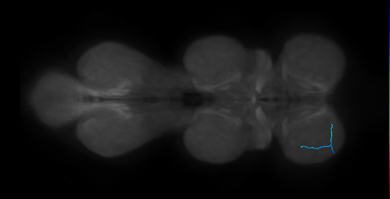 SNta19_ProLN_L (MANC:49043)