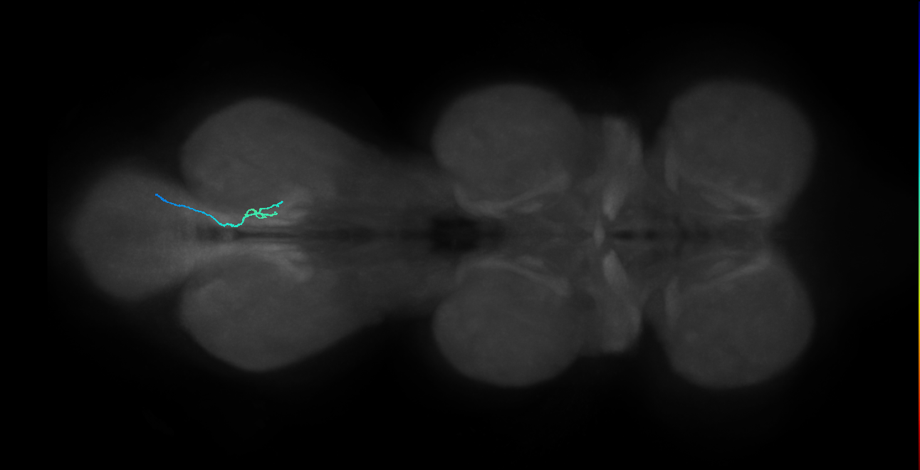 SNta20_MetaLN_R (MANC:53629)