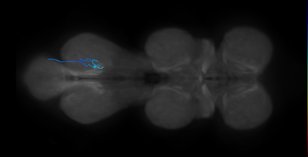 SNta20_MetaLN_R (MANC:53976)