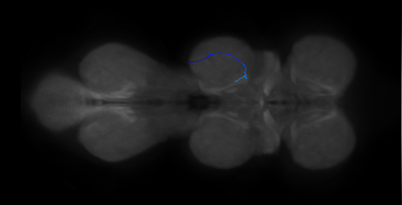 SNta18_MesoLN_R (MANC:56064)