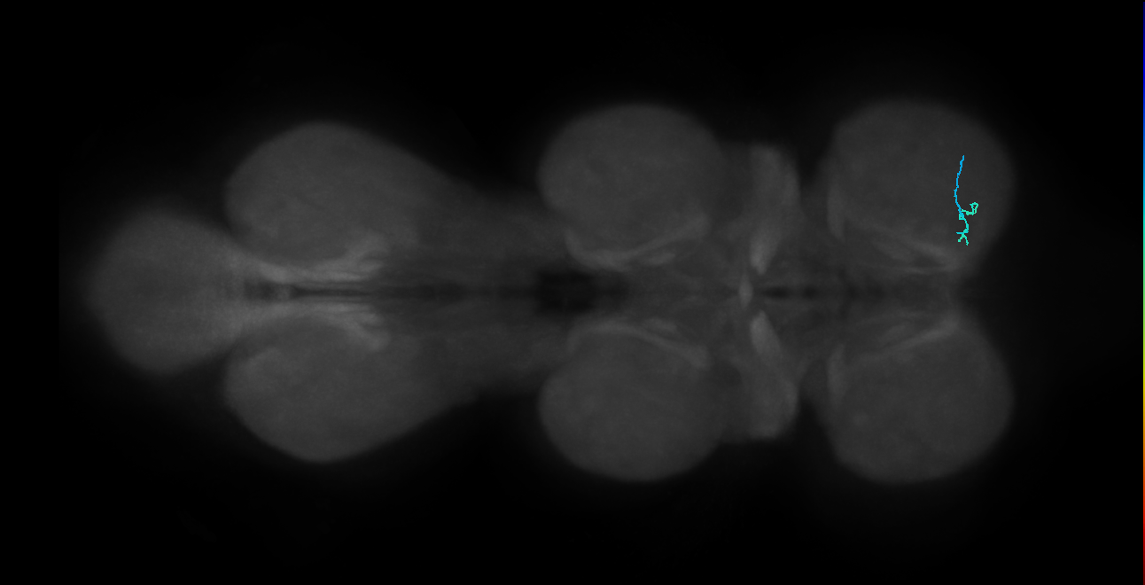 SNta19_ProLN_R (MANC:70210)