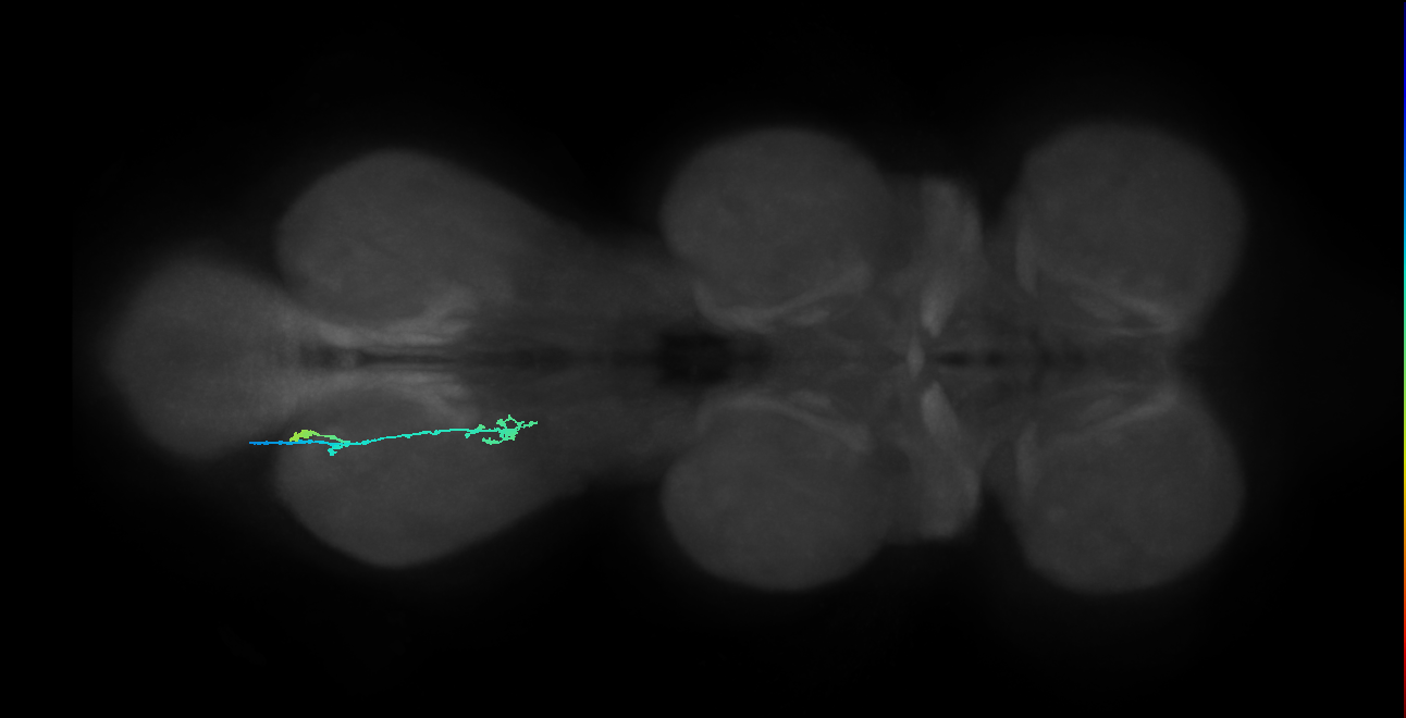 SNpp38_MetaLN_L (MANC:82116)