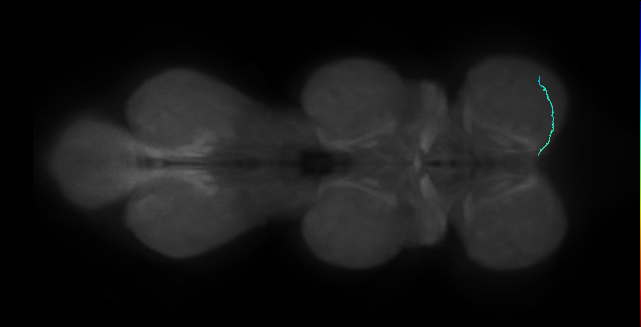 SNta19_ProLN_R (MANC:88721)