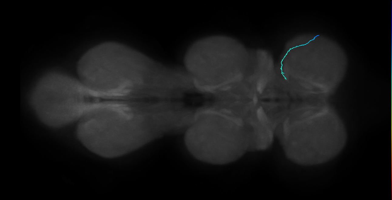 SNta15_ProLN_R (MANC:96459)