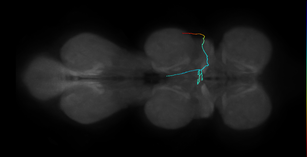 SNta10_PDMN_R (MANC:104220)