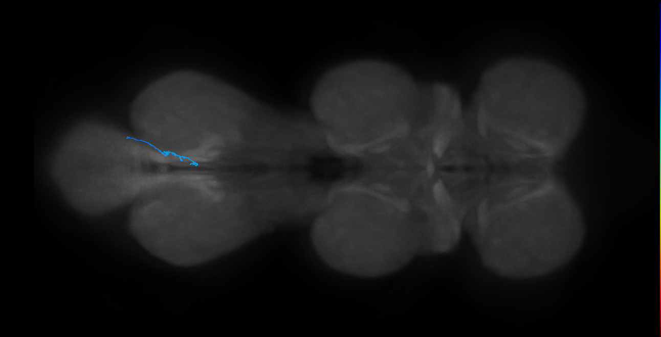 SNch10_MetaLN_R (MANC:116955)