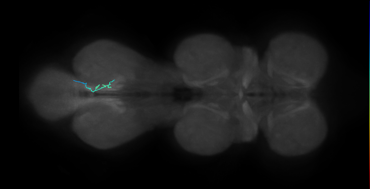 SNta20_MetaLN_R (MANC:117412)