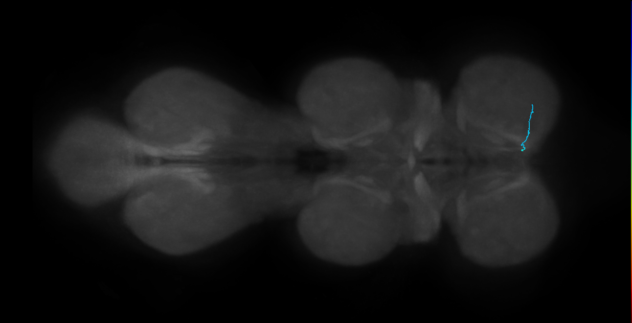 SNta24_ProLN_R (MANC:145568)