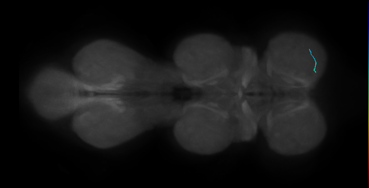 SNta19_ProLN_R (MANC:148643)