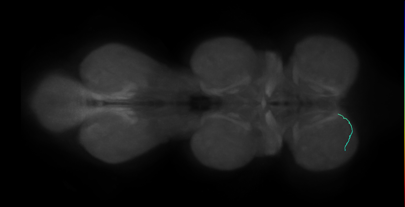 SNta15_ProLN_L (MANC:150627)