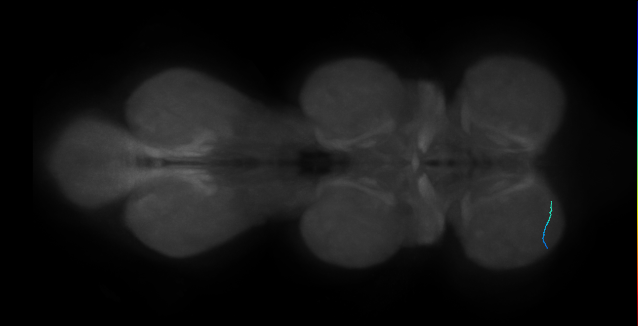 SNta19_ProLN_L (MANC:150656)