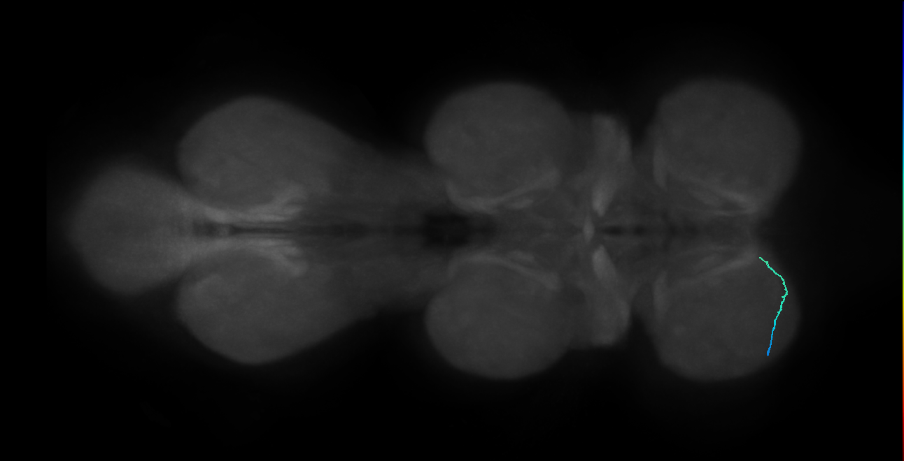 SNta15_ProLN_L (MANC:150666)