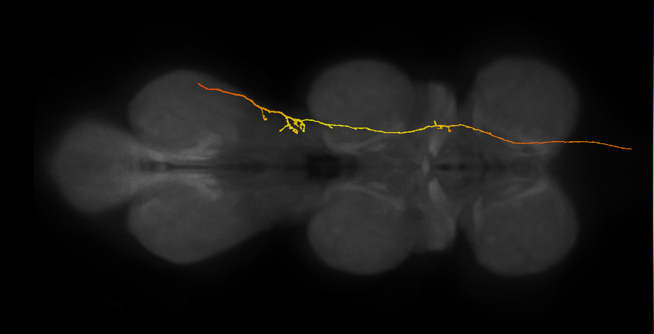 SApp25_DMetaN_R (MANC:156717)