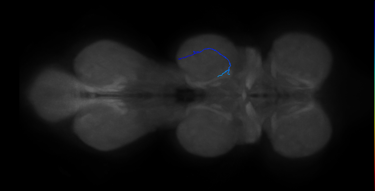 SNta18_MesoLN_R (MANC:157777)