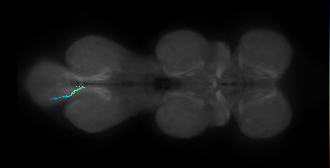 SNta19_MetaLN_L (MANC:158365)