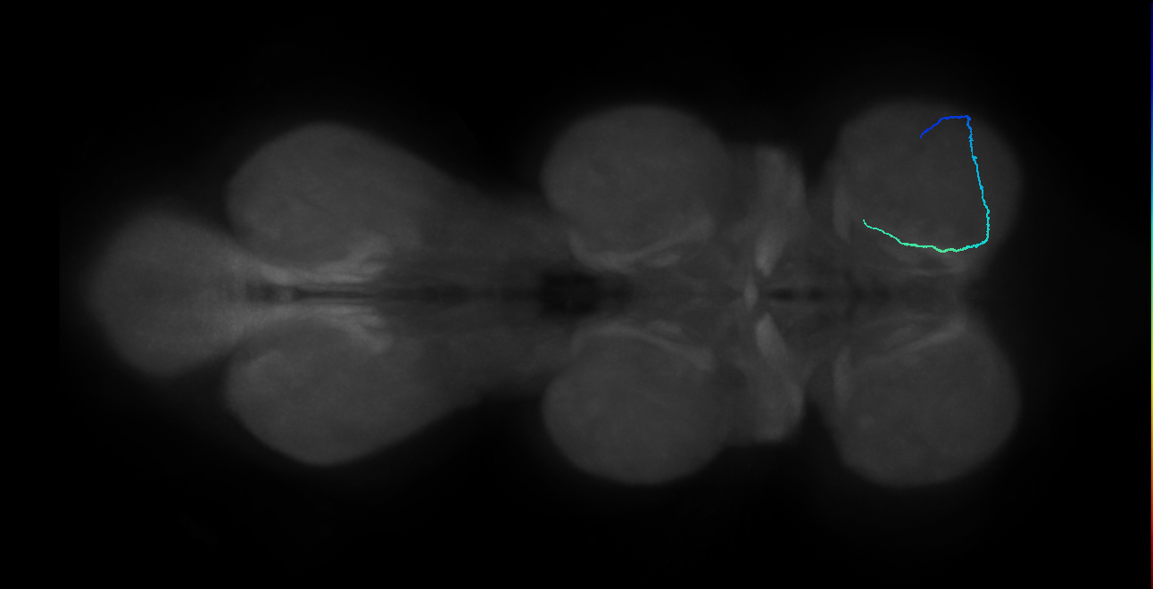 SNta24_ProLN_R (MANC:165840)