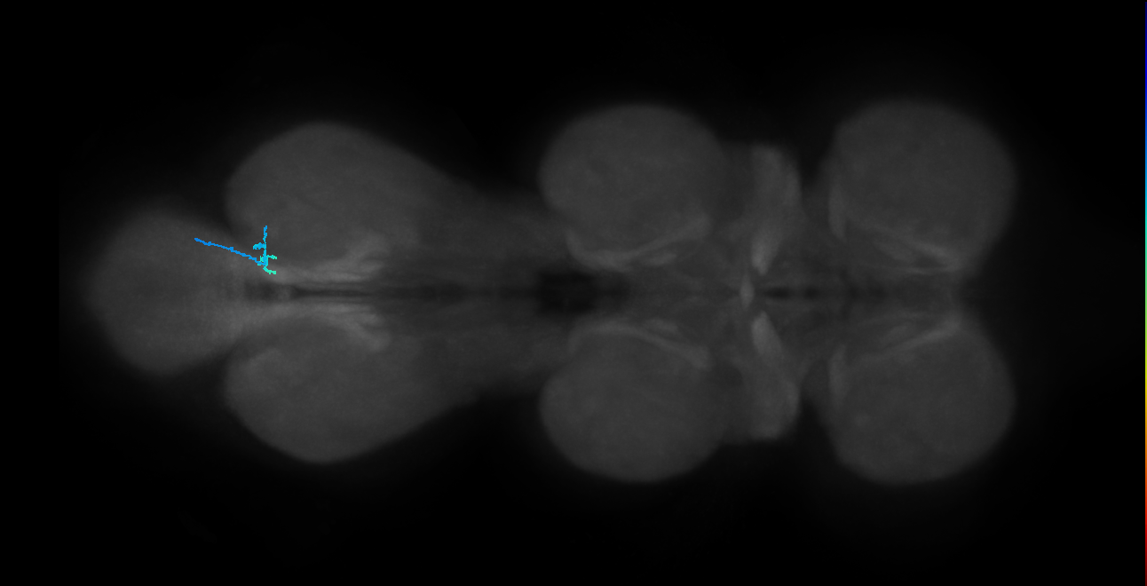 SNta22_MetaLN_R (MANC:170741)