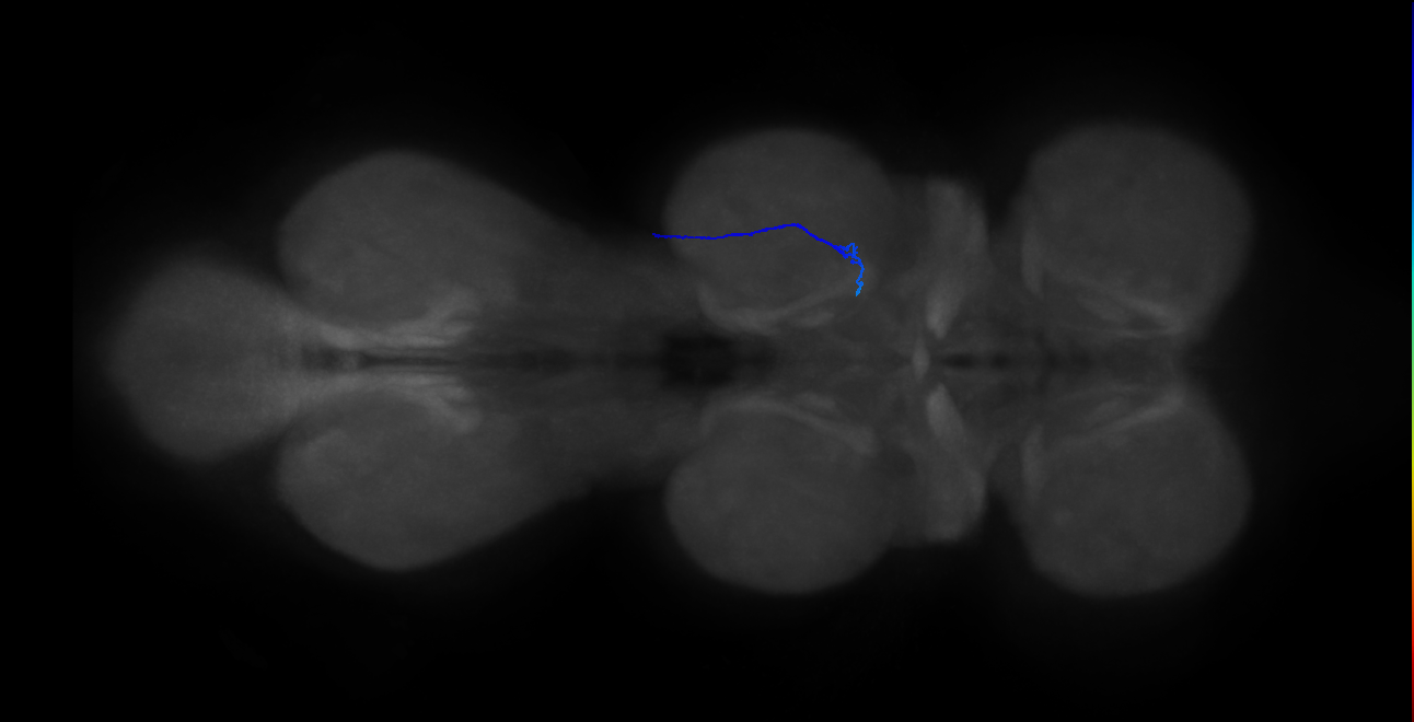 SNta24_MesoLN_R (MANC:177415)