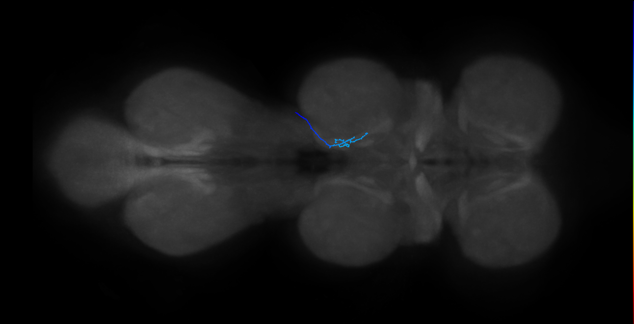 SNta20_MesoLN_R (MANC:177417)