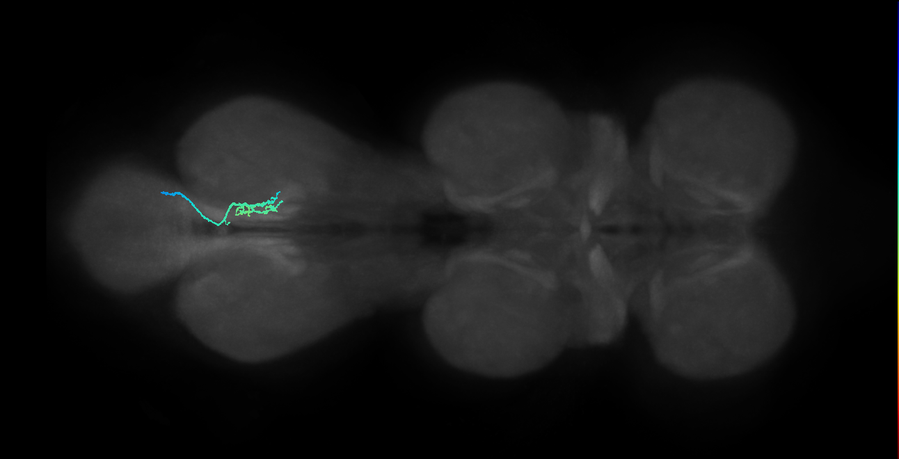 SNta20_MetaLN_R (MANC:178147)