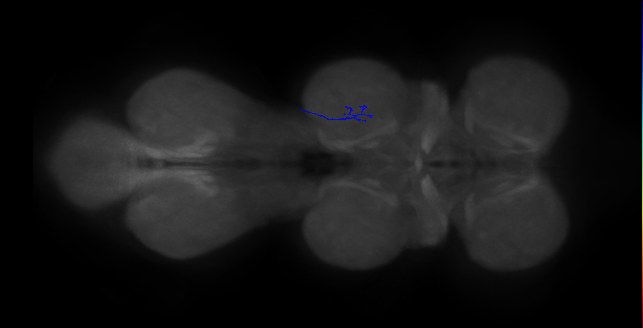 SNta20_MesoLN_R (MANC:179248)