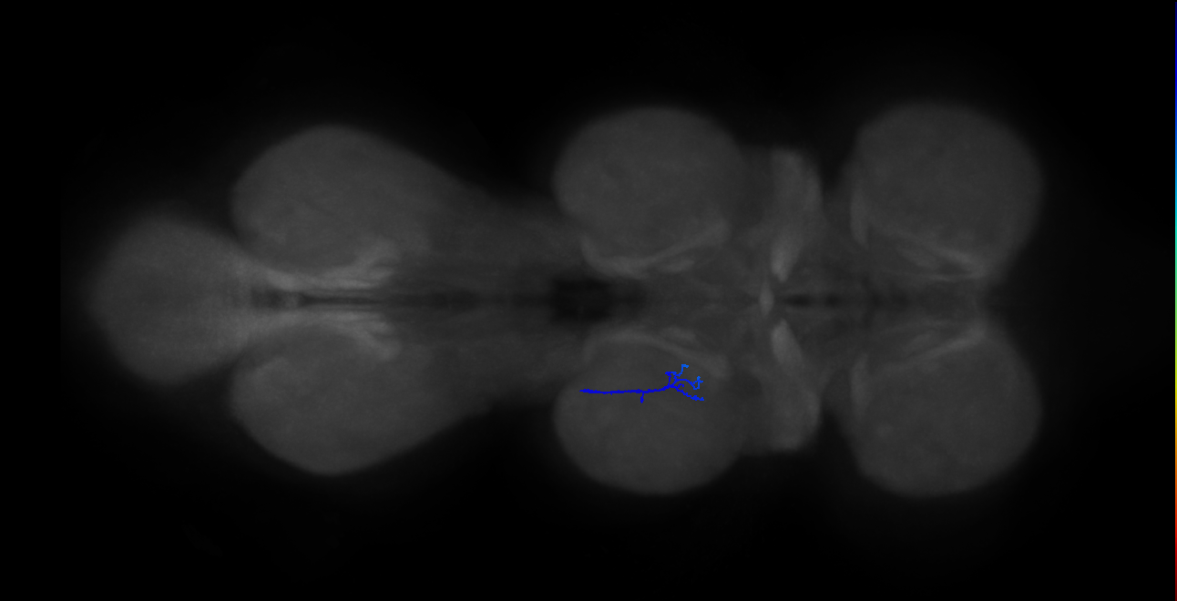 SNta20_MesoLN_L (MANC:25697838885)