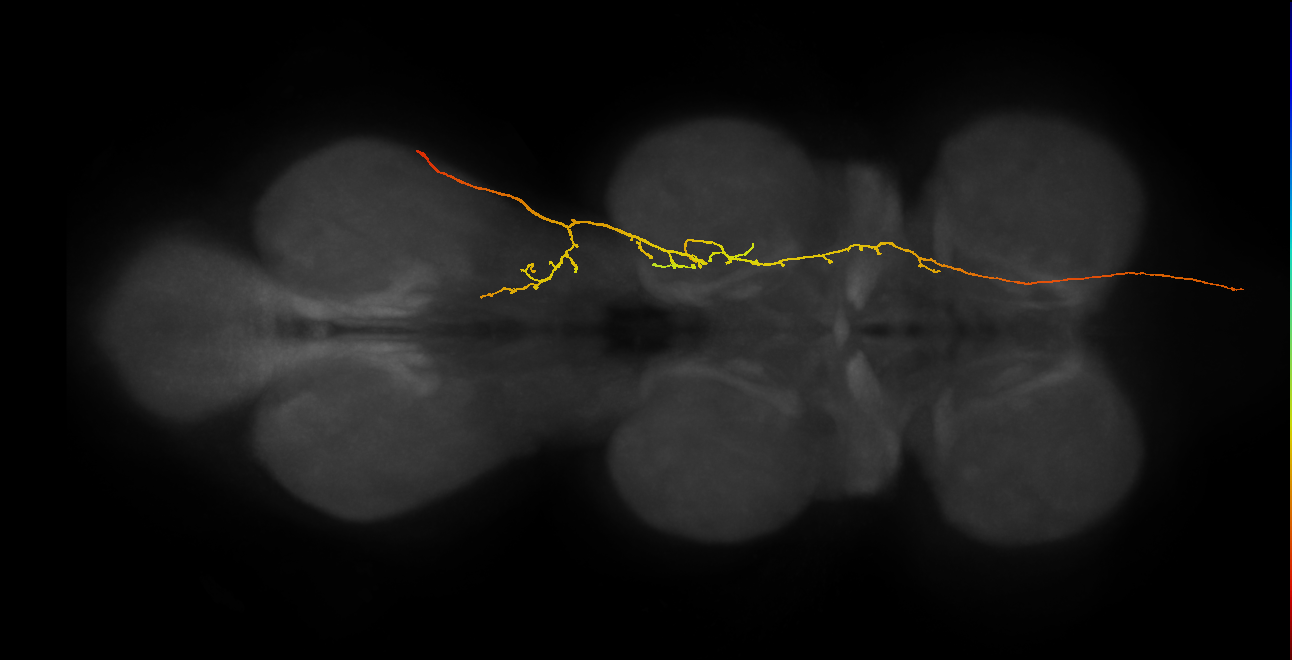 SApp19_DMetaN_R (MANC:53181849341)