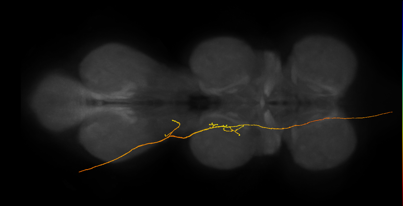 SApp21_DMetaN_L (MANC:53588191325)