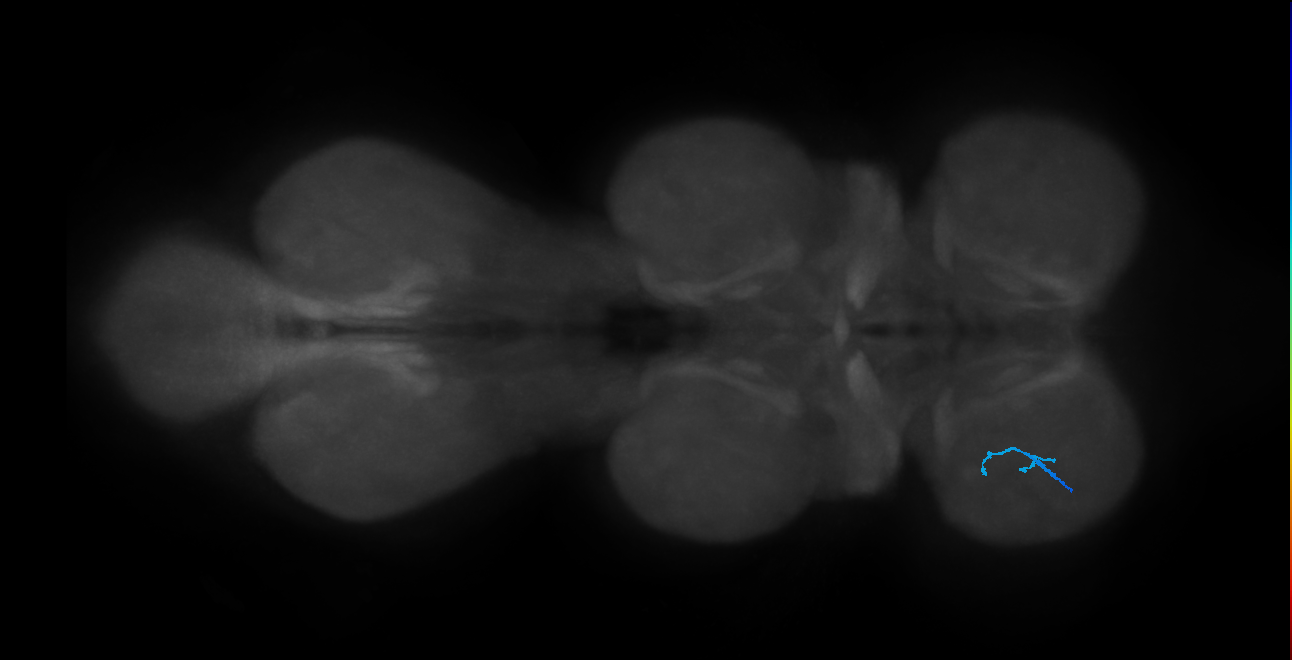 SNta21_ProLN_L (MANC:39660147784)