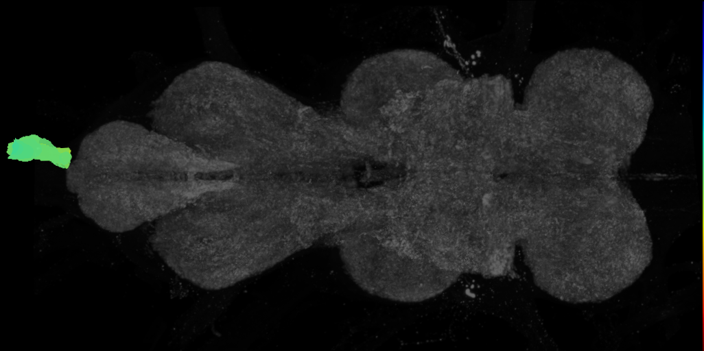 adult abdominal nerve trunk