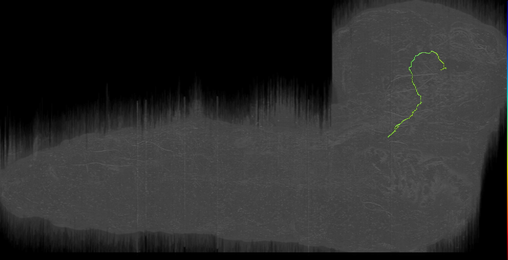DPMm1 desc s lat 1 Left (L1EM:11313556)