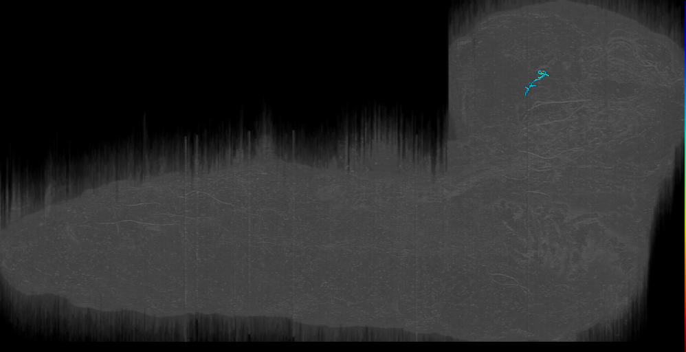 CM4 lineage neuron