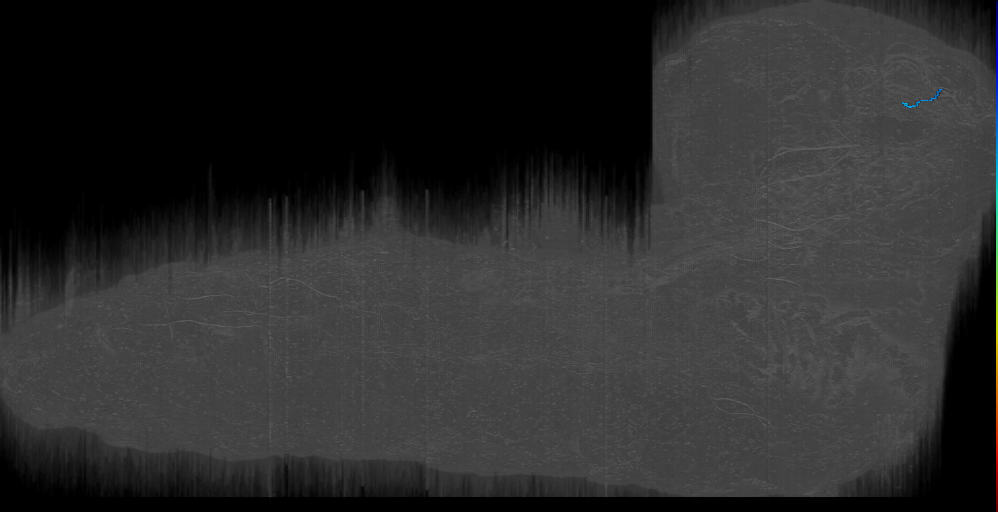DAMd1 s 1 Right (L1EM:14877179)