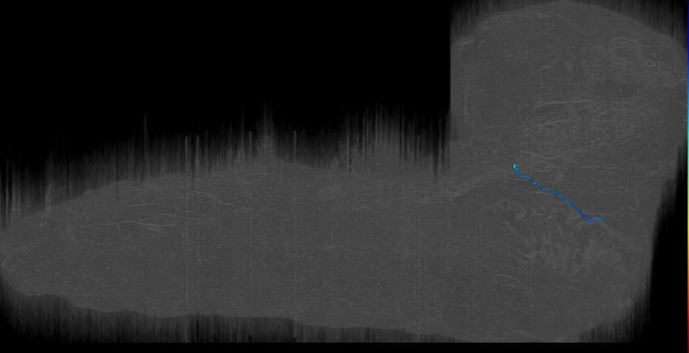 TR BAlv s 7 Right (L1EM:17634436)