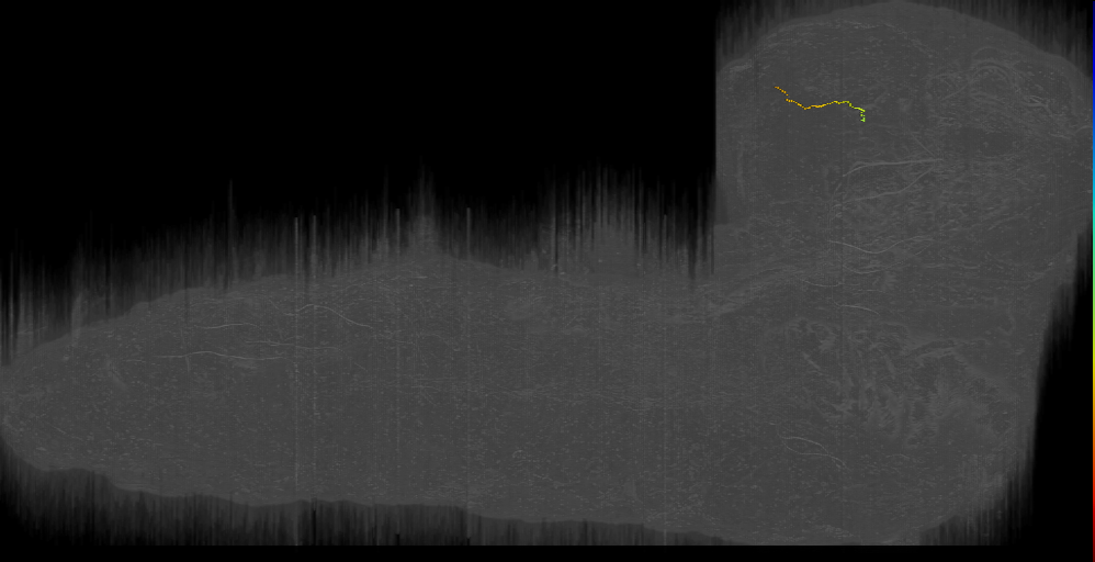 DPLl p s 1 Left (L1EM:17732214)