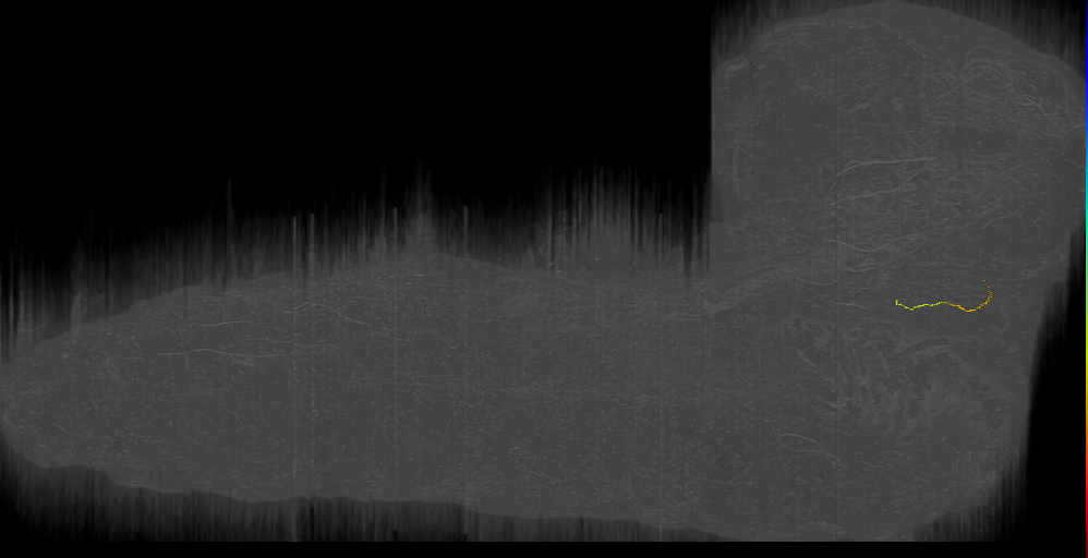 TR Balv s 8 Left (L1EM:17733190)