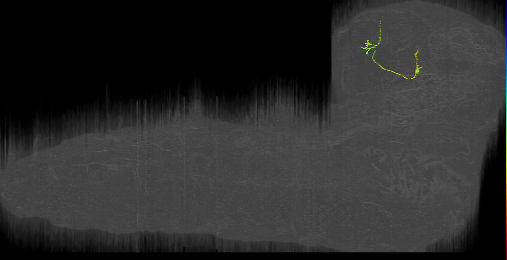 immature neuron