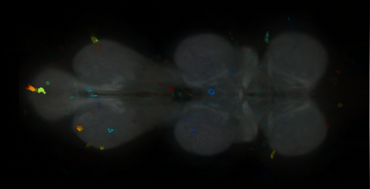 P{GMR31A02-GAL4} expression pattern